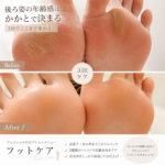 貴女のかかと、みられてますよ～