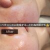 梅雨は・・・べたつくのに乾燥したお肌になっていませんか？